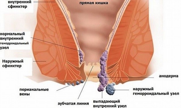 Как применять ихтиоловые свечи: инструкция Как применять ихтиоловые свечи: инструкция