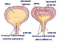 Способы быстро наполнить мочевой пузырь для диагностики Способы быстро наполнить мочевой пузырь для диагностики