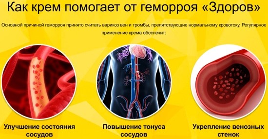 Можно ли быстро и навсегда избавиться от геморроя? Можно ли быстро и навсегда избавиться от геморроя?