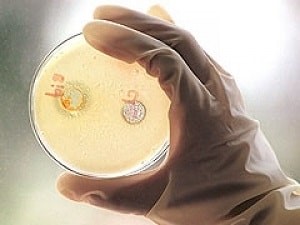 Как передается гепатит В Как передается гепатит В