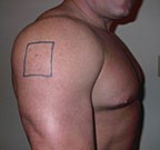 Правила выбора инсулиновых шприцев для инъекций Правила выбора инсулиновых шприцев для инъекций