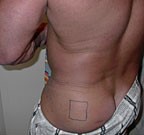 Правила выбора инсулиновых шприцев для инъекций Правила выбора инсулиновых шприцев для инъекций