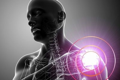 Ортез и бандаж на плечевой сустав: фиксация и иммобилизация плеча Ортез и бандаж на плечевой сустав: фиксация и иммобилизация плеча