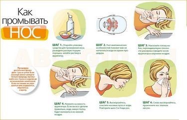 Чем промывать нос при гайморите: основные средства для промывания носа Чем промывать нос при гайморите: основные средства для промывания носа