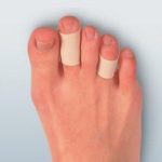 Как снять боль при пяточной шпоре: как лечить если болит пятка Как снять боль при пяточной шпоре: как лечить если болит пятка