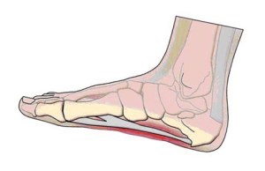 Как снять боль при пяточной шпоре: как лечить если болит пятка Как снять боль при пяточной шпоре: как лечить если болит пятка
