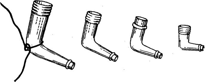 Свищи в кишечнике Свищи в кишечнике