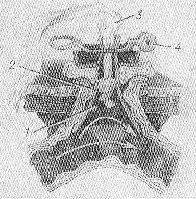 Свищи в кишечнике Свищи в кишечнике