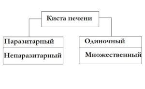 Что такое киста в печени и чем она опасна: симптомы и лечение Что такое киста в печени и чем она опасна: симптомы и лечение