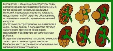 Какие симптомы свидетельствуют об образовании кисты на почке Какие симптомы свидетельствуют об образовании кисты на почке