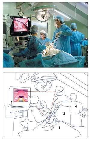 Как лечится киста селезенки? Как лечится киста селезенки?