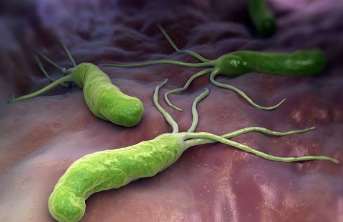 Можно ли кофе при язве желудка? Можно ли кофе при язве желудка?