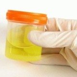 Моча у грудничка: запах, цвет Моча у грудничка: запах, цвет