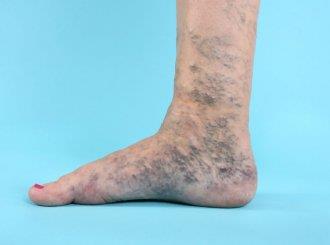 Особенности забора крови на сахар для получения точных результатов Особенности забора крови на сахар для получения точных результатов