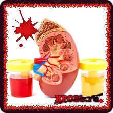 Кровь в моче у мужчины без боли, что это может быть: причины Кровь в моче у мужчины без боли, что это может быть: причины