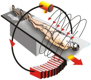 Компьютерная томография носовых пазух Компьютерная томография носовых пазух