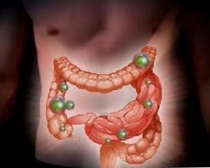 Учимся лечить дисбактериоз с помощью народных средств Учимся лечить дисбактериоз с помощью народных средств