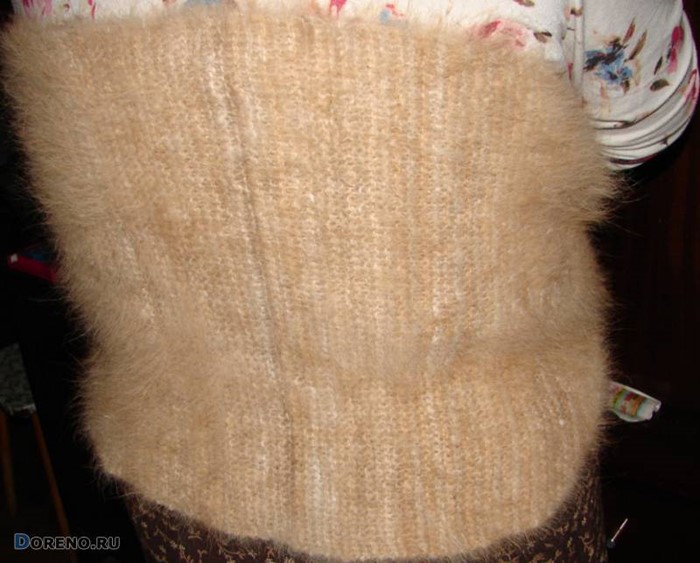 Поликистоз почек и беременность Поликистоз почек и беременность