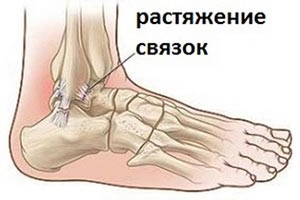 Связки голеностопного сустава Связки голеностопного сустава