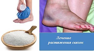 Связки голеностопного сустава Связки голеностопного сустава