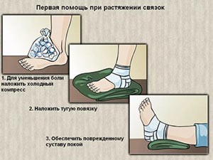 Связки голеностопного сустава Связки голеностопного сустава