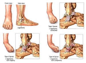 Связки голеностопного сустава Связки голеностопного сустава