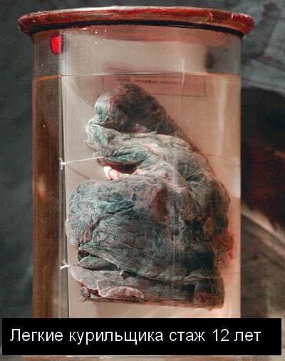 Легкие курящего человека Легкие курящего человека