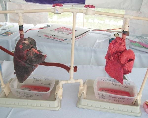 Легкие курящего человека Легкие курящего человека