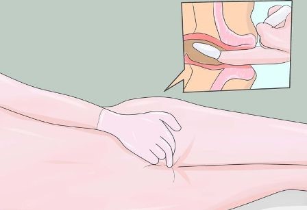 Выбираем действенные и эффективные средства от геморроя Выбираем действенные и эффективные средства от геморроя