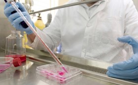 Миеломная болезнь, множественная миелома: симптомы, лечение, диагностика, прогноз Миеломная болезнь, множественная миелома: симптомы, лечение, диагностика, прогноз