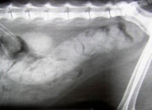 Хронический запор Хронический запор