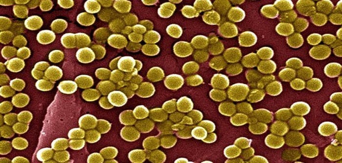 Ангина и температура: возможно ли одно без другого? Ангина и температура: возможно ли одно без другого?