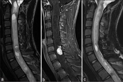Можно ли в домашних условиях греть почки если они болят? Можно ли в домашних условиях греть почки если они болят?