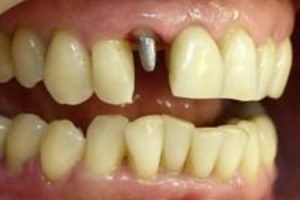 МРТ височно-нижнечелюстного сустава: томография челюстно-лицевого сустава МРТ височно-нижнечелюстного сустава: томография челюстно-лицевого сустава