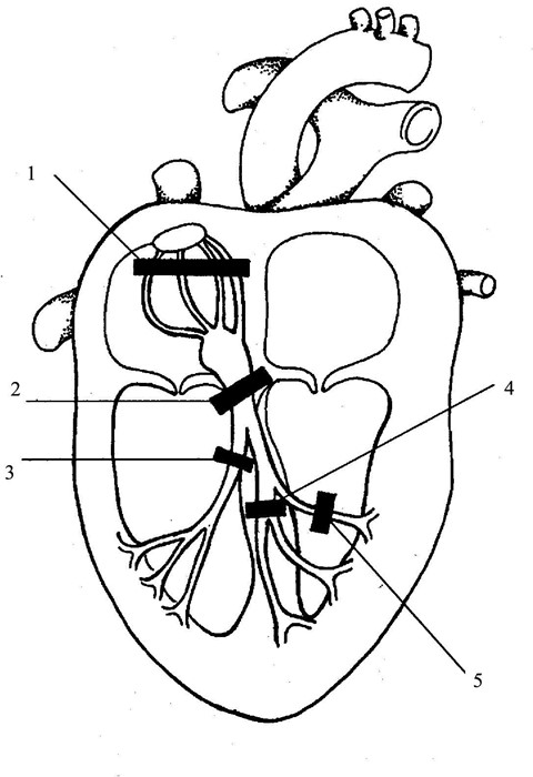Разновидности, причины и диагностика блокад сердца Разновидности, причины и диагностика блокад сердца