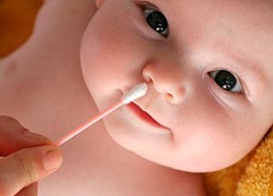 Сопли у новорожденного: как с ними бороться? Сопли у новорожденного: как с ними бороться?