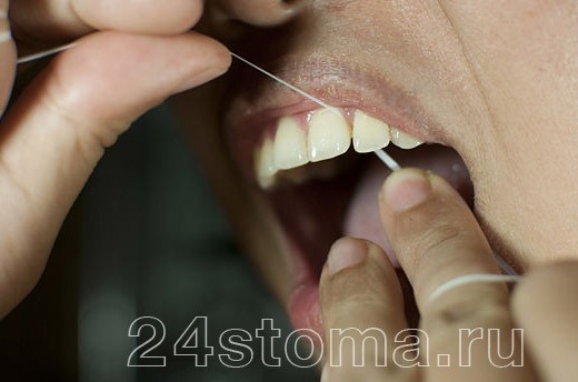 Устранение сильного запаха изо рта Устранение сильного запаха изо рта