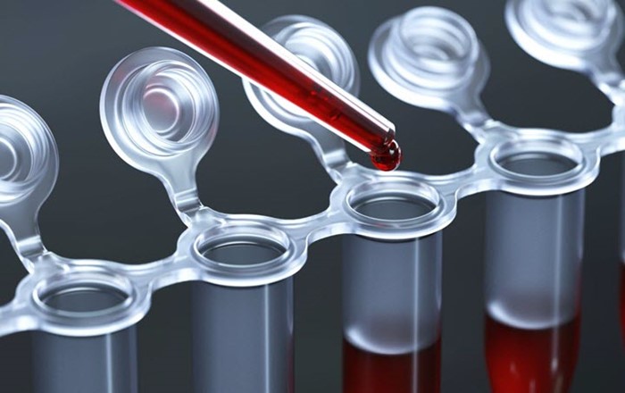 Норма АСТ в крови Норма АСТ в крови