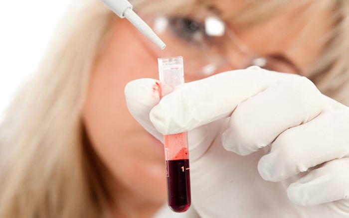 Норма АСТ в крови Норма АСТ в крови