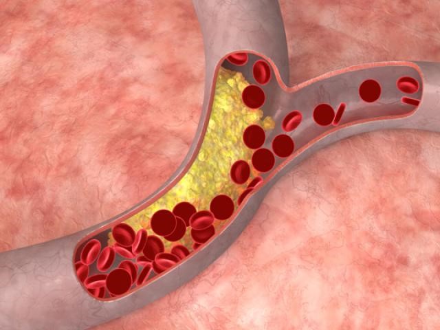 Нормальные показатели нормы сахара и холестерина в крови Нормальные показатели нормы сахара и холестерина в крови