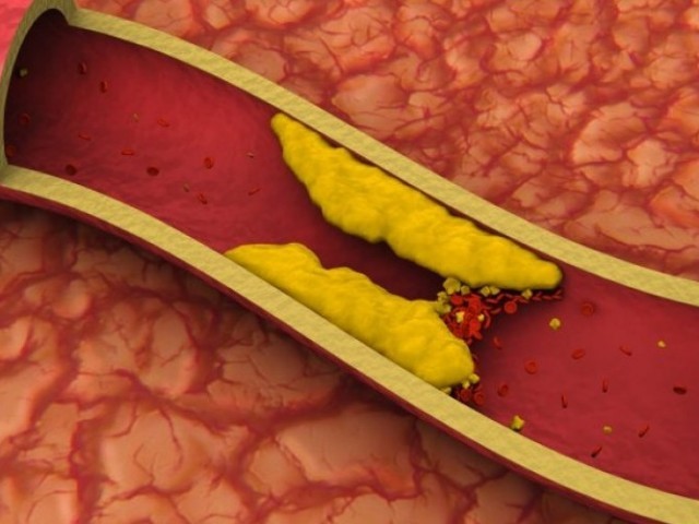 Нормальные показатели нормы сахара и холестерина в крови Нормальные показатели нормы сахара и холестерина в крови