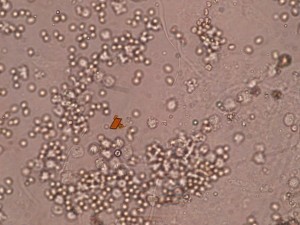 Оценка показателей общего анализа мочи Оценка показателей общего анализа мочи