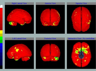 УЗДГ сосудов почек - быстрый и комфортный способ диагностики УЗДГ сосудов почек - быстрый и комфортный способ диагностики