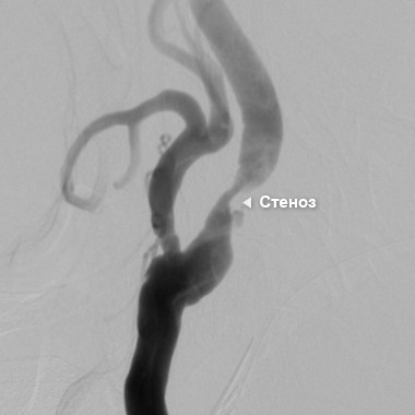 УЗДГ сосудов почек - быстрый и комфортный способ диагностики УЗДГ сосудов почек - быстрый и комфортный способ диагностики