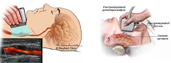 УЗДГ сосудов почек - быстрый и комфортный способ диагностики УЗДГ сосудов почек - быстрый и комфортный способ диагностики