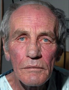 Болит низ живота справа: причины и возможные заболевания Болит низ живота справа: причины и возможные заболевания