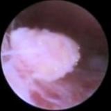 Остеоартроз височно-нижнечелюстного сустава: лечение ВНЧС Остеоартроз височно-нижнечелюстного сустава: лечение ВНЧС