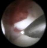 Остеоартроз височно-нижнечелюстного сустава: лечение ВНЧС Остеоартроз височно-нижнечелюстного сустава: лечение ВНЧС