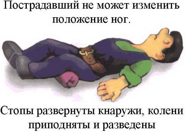 Симптомы и лечение перелома лонной кости таза Симптомы и лечение перелома лонной кости таза