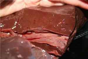 Песок в желчном пузыре - симптомы и лечение Песок в желчном пузыре - симптомы и лечение